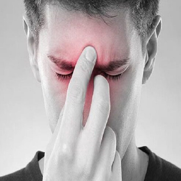 سینوزیت و راه های مقابله با آن را بیشتر بشناسیم